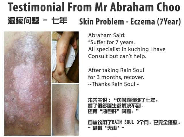 rain-testimonials-eczema-03
