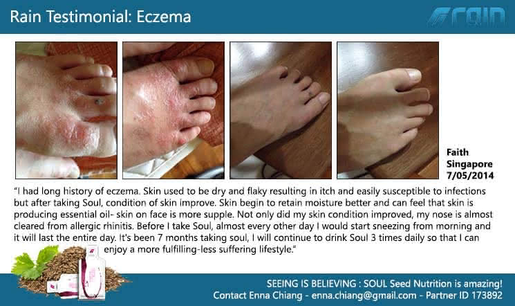 rain-testimonials_eczema3